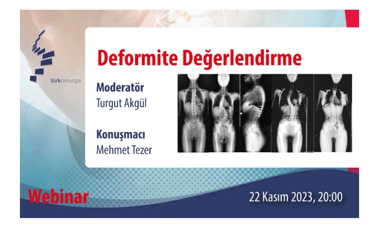 Tod Webinar ''Deformite Değerlendirme ''